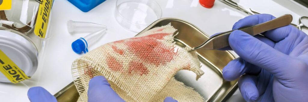 Usuwanie plam z krwi. Obrazek w artykule Jak usunąć plamy z krwi? Domowe sposoby na skuteczne usuwanie starych plam z krwi